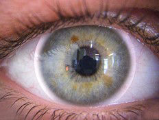 Weichlinsen Monatslinsen KontaktlinsenSalzburg Kontaktlinse Tageslinse Wegwerflinse Menicon